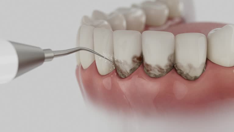 Reliable Tooth Extraction contractor in Wellington, TX by Smile Center Dentistry